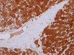 GPT Polyclonal Antibody
