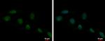 HMGB1 Polyclonal Antibody
