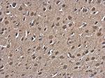 HSP70 Antibody in Immunohistochemistry (Paraffin) (IHC (P))