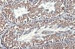 HSP70 Antibody in Immunohistochemistry (Paraffin) (IHC (P))