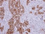 HSP70 Polyclonal Antibody