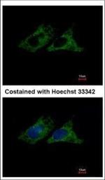 ITGB1 Polyclonal Antibody