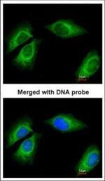 Cytokeratin 18 Polyclonal Antibody