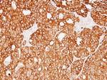 Cytokeratin 18 Antibody in Immunohistochemistry (Paraffin) (IHC (P))