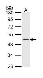 Cytokeratin 18 Antibody in Western Blot (WB)
