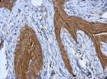 Cytokeratin 18 Antibody in Immunohistochemistry (Paraffin) (IHC (P))