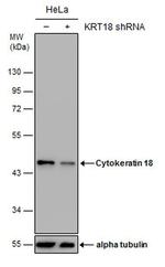 Cytokeratin 18 Antibody