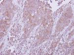 MyD88 Polyclonal Antibody