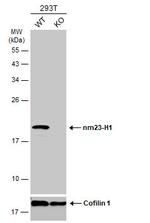 NME1 Antibody in Western Blot (WB)