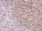 PI3K p85 alpha Polyclonal Antibody