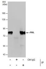 PML Antibody in Immunoprecipitation (IP)