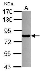PML Polyclonal Antibody
