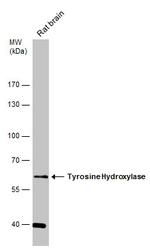 Tyrosine Hydroxylase Antibody in Western Blot (WB)