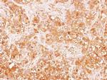 Tyrosine Hydroxylase Antibody in Immunohistochemistry (Paraffin) (IHC (P))