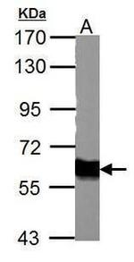 Tyrosine Hydroxylase Antibody in Western Blot (WB)