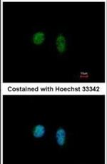 THRA Antibody in Immunocytochemistry (ICC/IF)