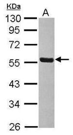 THRA Antibody in Western Blot (WB)