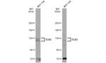 TLR3 Antibody in Western Blot (WB)