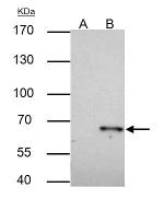 TRAF6 Antibody in Immunoprecipitation (IP)