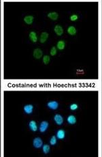 XPA Antibody in Immunocytochemistry (ICC/IF)