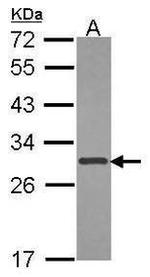 XPA Antibody in Western Blot (WB)