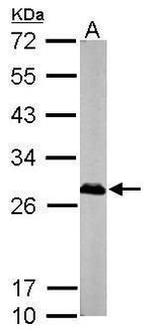 XPA Antibody in Western Blot (WB)