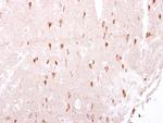 LRRK2 Antibody in Immunohistochemistry (Paraffin) (IHC (P))