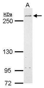 LRRK2 Antibody in Western Blot (WB)