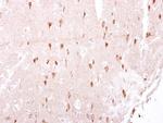 LRRK2 Antibody in Immunohistochemistry (Paraffin) (IHC (P))