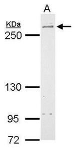 LRRK2 Antibody in Western Blot (WB)