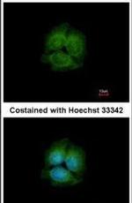 LRRK2 Antibody in Immunocytochemistry (ICC/IF)