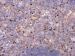 CD86 Antibody in Immunohistochemistry (Paraffin) (IHC (P))