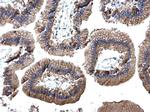 EpCAM Antibody in Immunohistochemistry (Paraffin) (IHC (P))