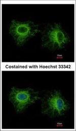 MYL1 Polyclonal Antibody