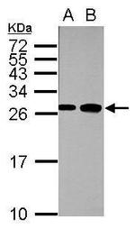 MYL1 Antibody in Western Blot (WB)
