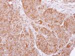 cIAP2 Polyclonal Antibody