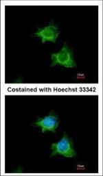 XIAP Polyclonal Antibody