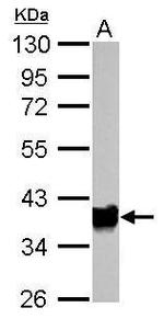 Arginase 1 Antibody in Western Blot (WB)