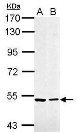Caspase 10 Antibody in Western Blot (WB)