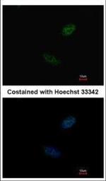 CDX2 Polyclonal Antibody