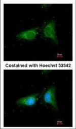 beta COP Polyclonal Antibody