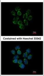 Ceruloplasmin Polyclonal Antibody