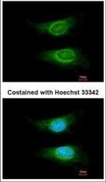 CD55 Polyclonal Antibody