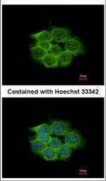 ENO1 Polyclonal Antibody