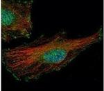 FMRP Antibody in Immunocytochemistry (ICC/IF)