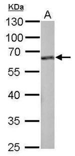 FMRP Antibody in Western Blot (WB)