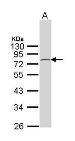 FMRP Antibody in Western Blot (WB)