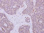 IRS1 Polyclonal Antibody