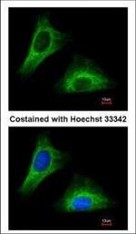 Cytokeratin 5 Antibody in Immunocytochemistry (ICC/IF)