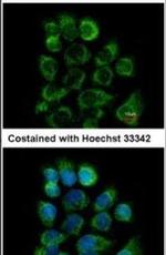 CD46 Antibody in Immunocytochemistry (ICC/IF)